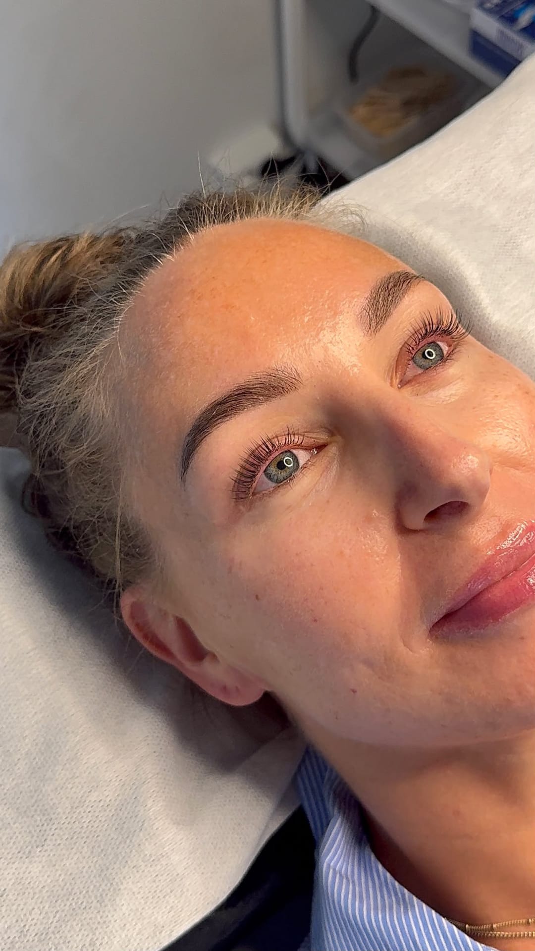 Resultat etter koreansk vippeløft hos Beauty by Ida Marie